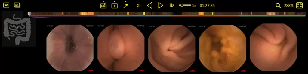 OMOMHD-Smart-Vue-smart-view